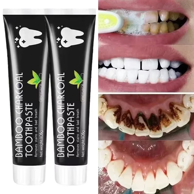 Teeth Whitening Yellow Teeth - Whitening Tandpasta Bamboe Houtskool Tandpasta Adsorbeert