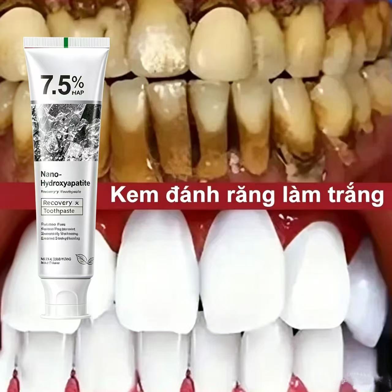 Hydroxyapatite Toothpaste - 7,5% Hydroxyapatiet Probiotische Whitening Tandpasta Emaille
