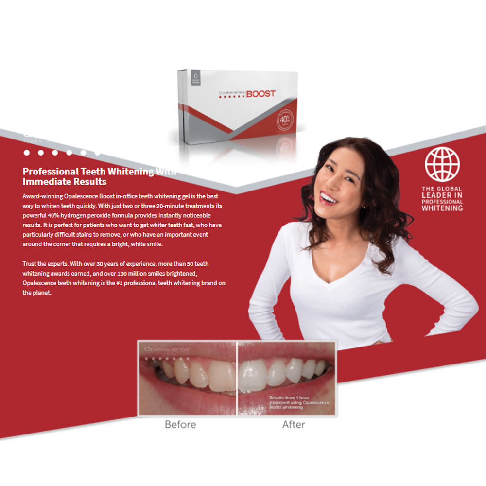 Opalescence Boost 40% PF Ameri - Teeth Whitening Gel Opalescence recensie en prijs