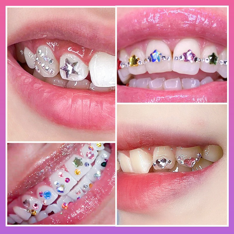 Nieuwe Professionele Tandjuwee - Tooth Gem Kit recensie en prijs