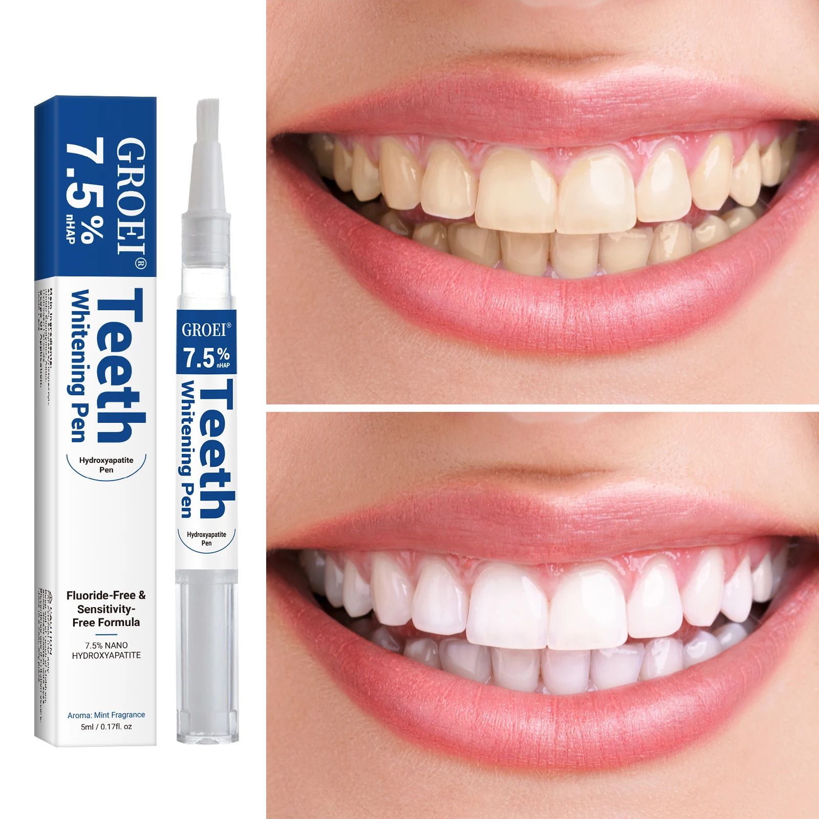 Hydroxyapatite Tand Whitening  - Teeth Whitening Singapore recensie en prijs