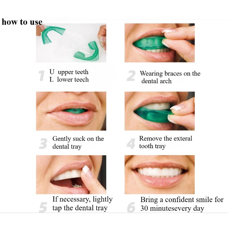 Set Tanden Whitening Lade U-vo - Teeth Whitening With Trays recensie en prijs