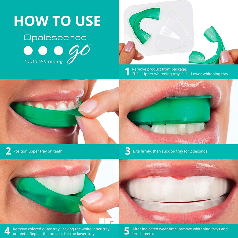 Waterstofperoxide Voor Tanden  - Teeth Whitening With Trays recensie en prijs