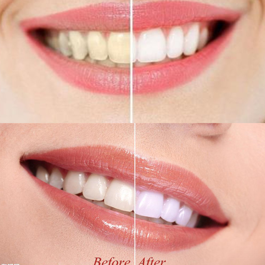 Bamboe Houtskool Tanden Dental - Teeth Whitening Ingredients recensie en prijs