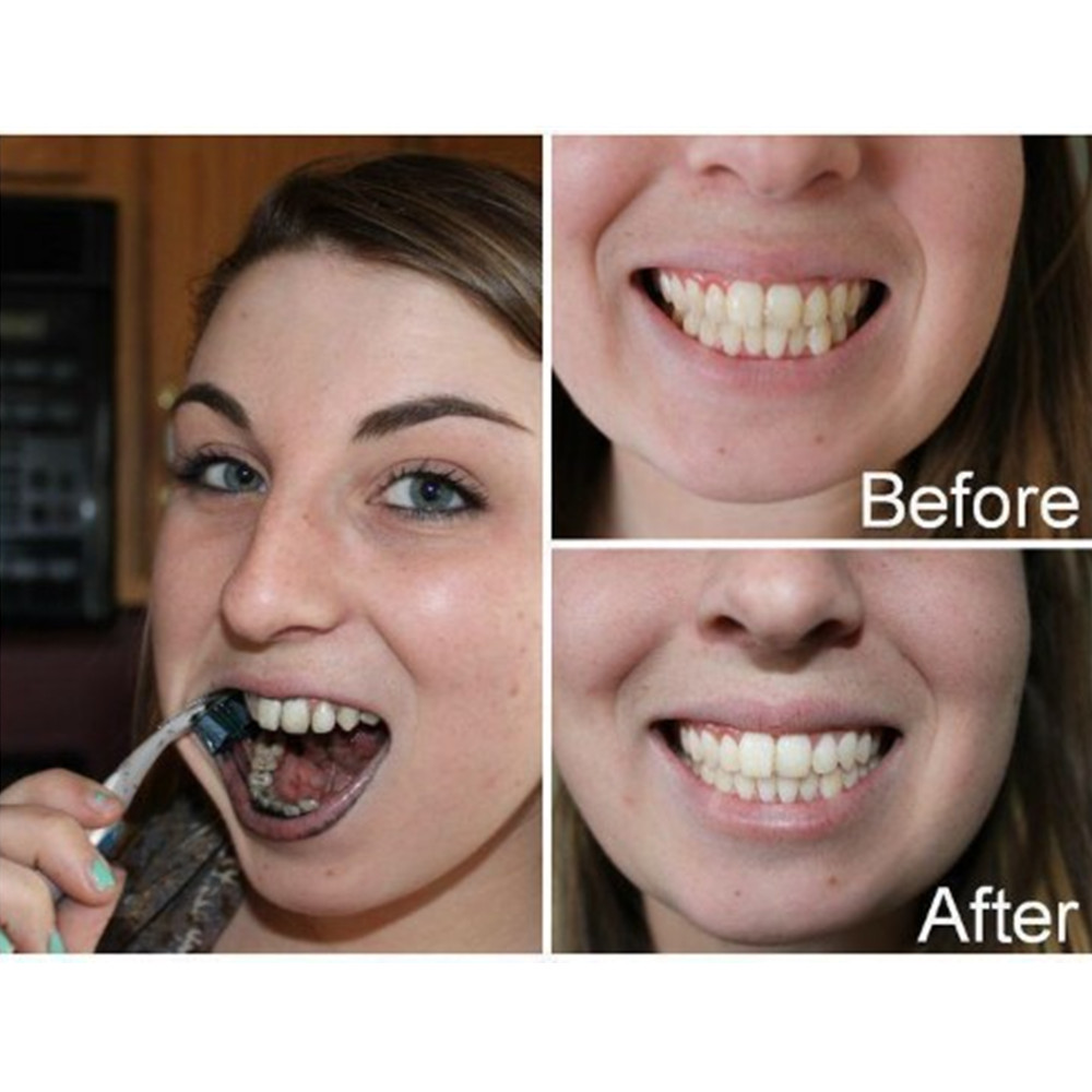 Bamboe Houtskool Tanden Dental - Teeth Whitening Ingredients recensie en prijs