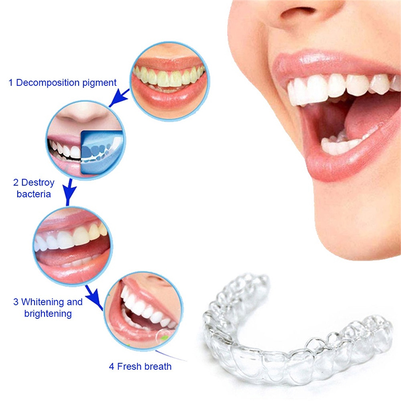 Comfort Fit Siliconen Mondbakj - Teeth Whitening With Trays recensie en prijs