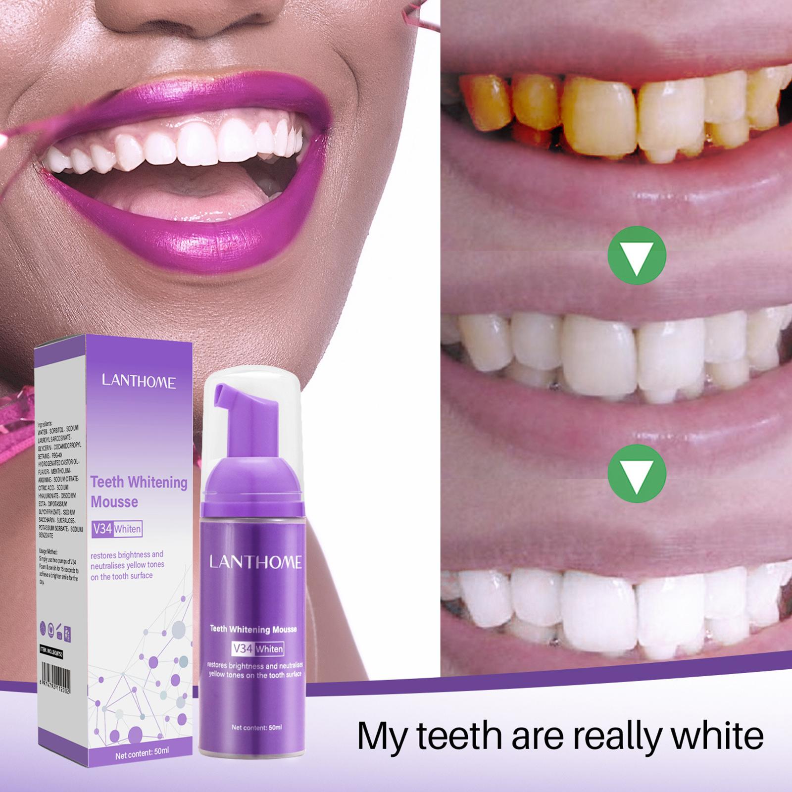V34 Mousse Tanden Reinigen Tan - Teeth Whitening Yellow Teeth recensie en prijs