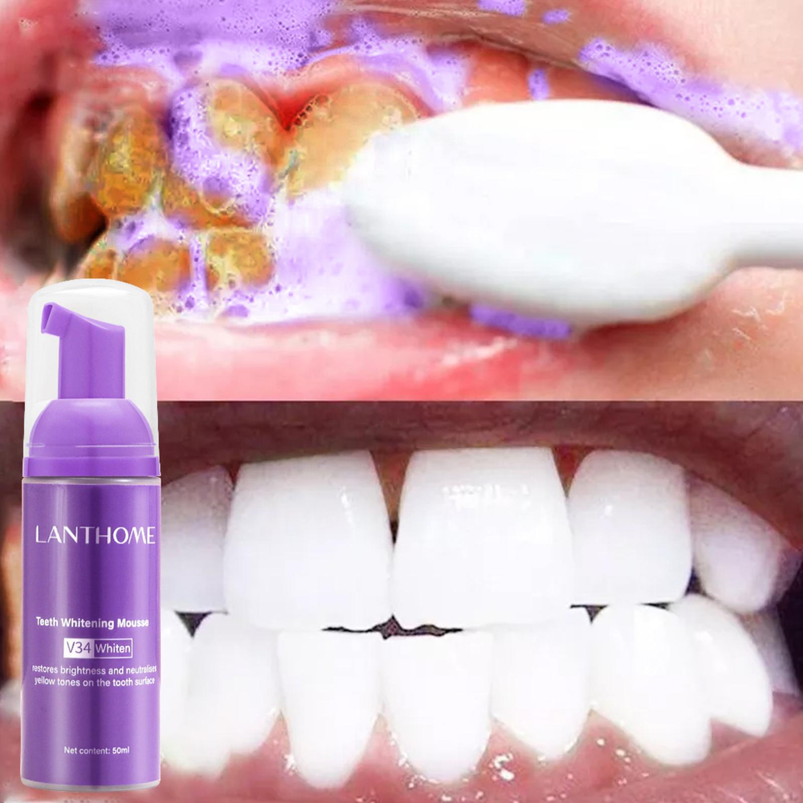 V34 Mousse Tanden Reinigen Tan - Teeth Whitening Yellow Teeth recensie en prijs