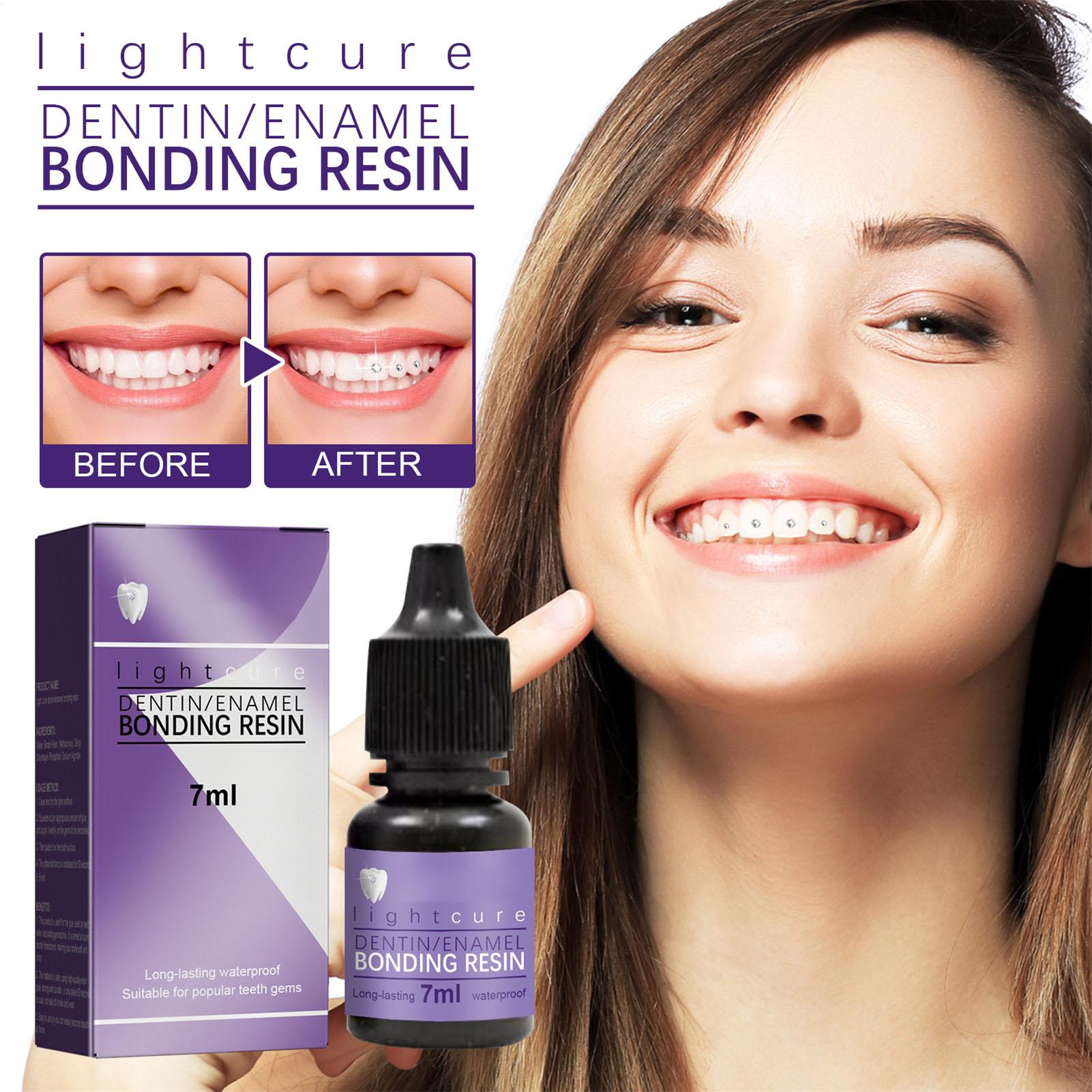 7ml Tandjuweel Lijm Tandheelku - Tooth Gem Kit recensie en prijs