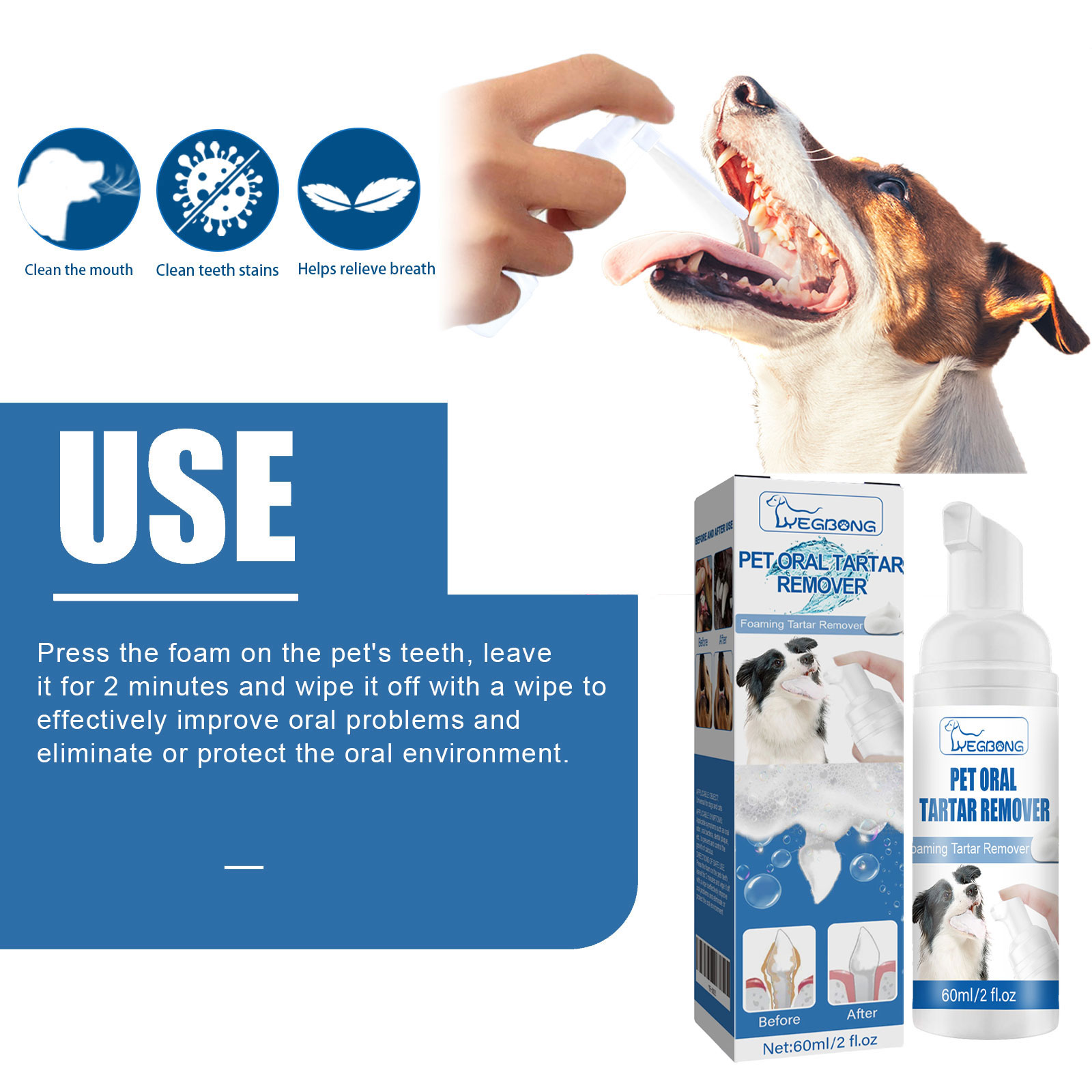Yegbong Tandsteenverwijderaar  - Teeth Whitening Yellow Teeth recensie en prijs