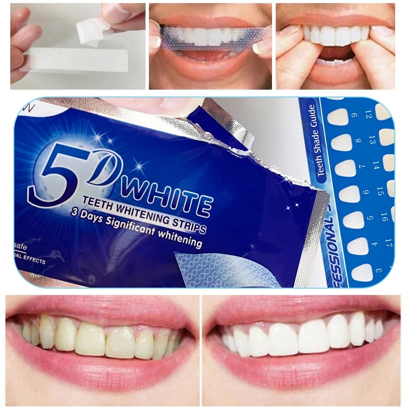 1/7/14 paar Tanden Whitening S - Teeth Whitening Bleaching Kit recensie en prijs