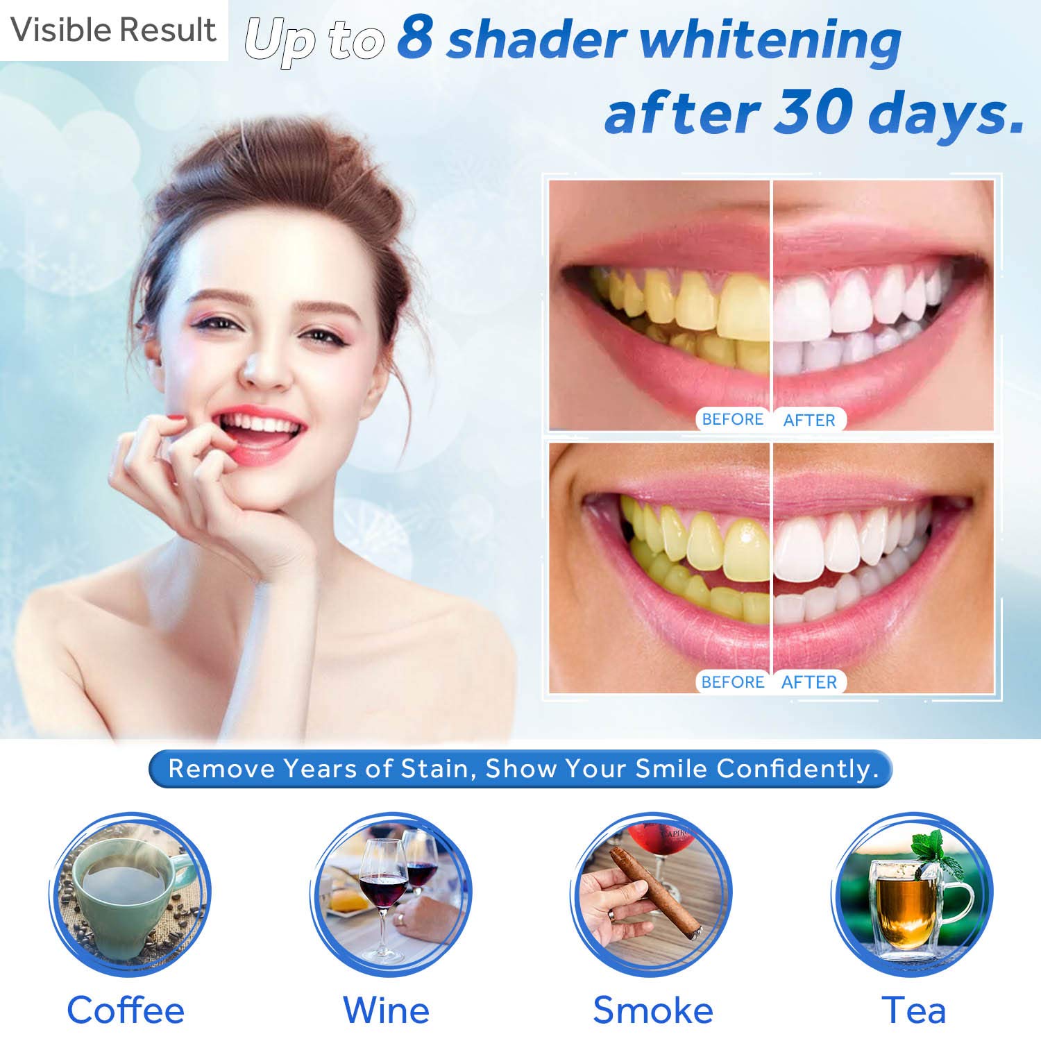 Tanden Whitening Gel Refill Sp - Teeth Whitening Singapore recensie en prijs