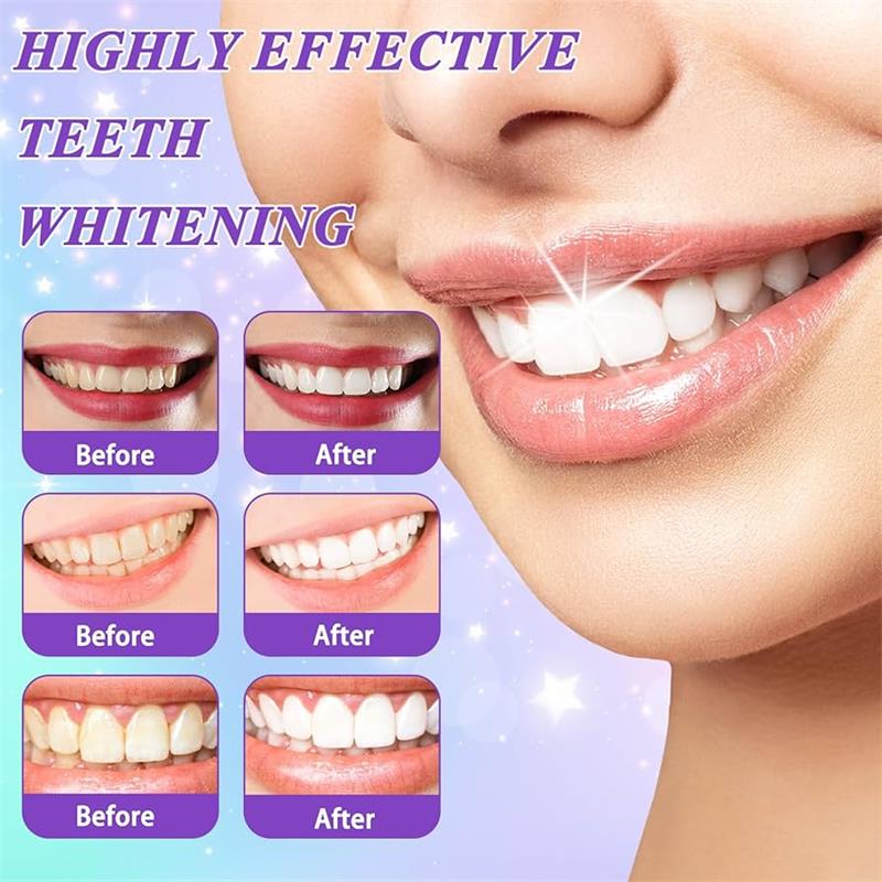 9D Paarse Tandenbleek Tandpast - Teeth Whitening Natural recensie en prijs