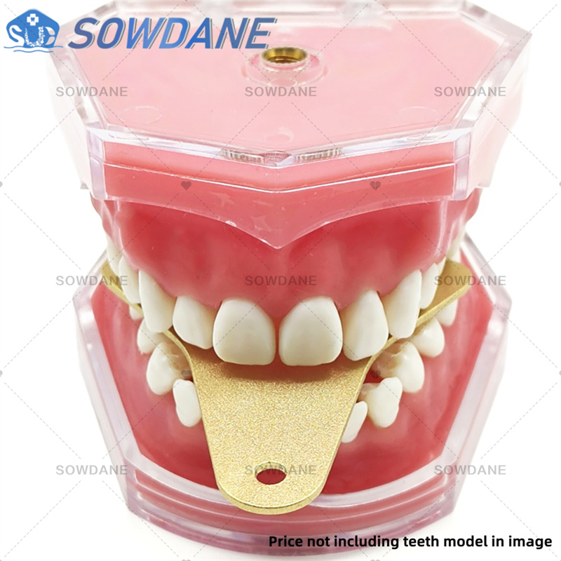 Dental Lab Afdruklepels om Cen - Teeth Whitening Tray recensie en prijs