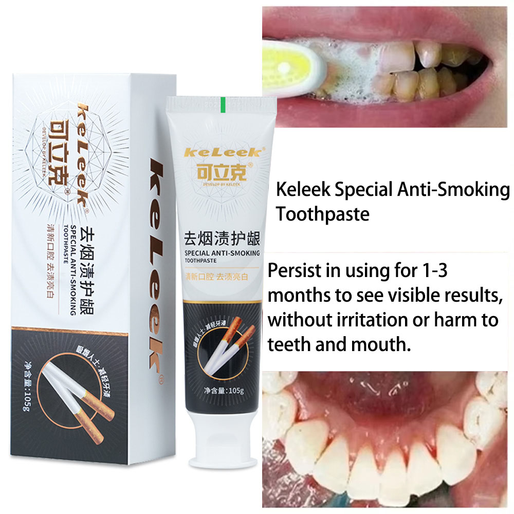 Tanden bleken Tandpasta Verwij - Teeth Whitening/Bleaching recensie en prijs