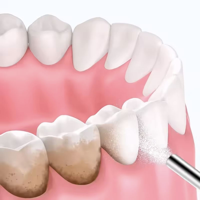 130g Tandbleekpoeder voor zand - Teeth Whitening Ingredients recensie en prijs