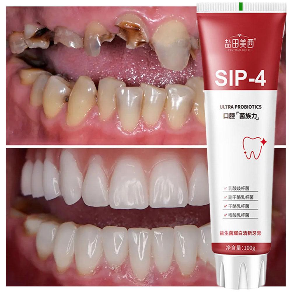 100g Sip-4 Probiotische Whiten - Teeth Whitening Yellow Teeth recensie en prijs