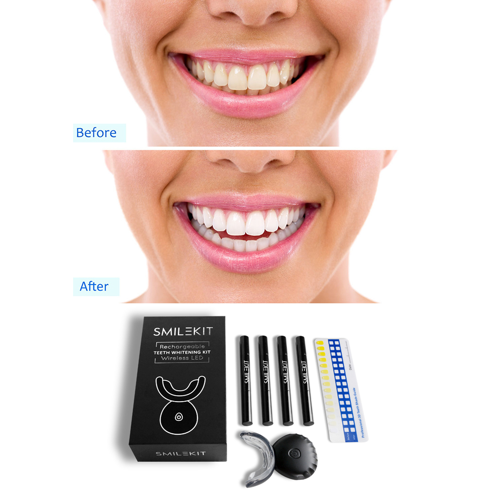 Nieuwe elektrische tanden blek - Teeth Whitening Bleaching Kit recensie en prijs