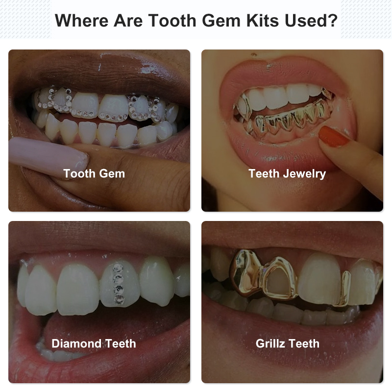 Tand Gem Set Lijm Kit Met Uv G - Tooth Gem Kit recensie en prijs