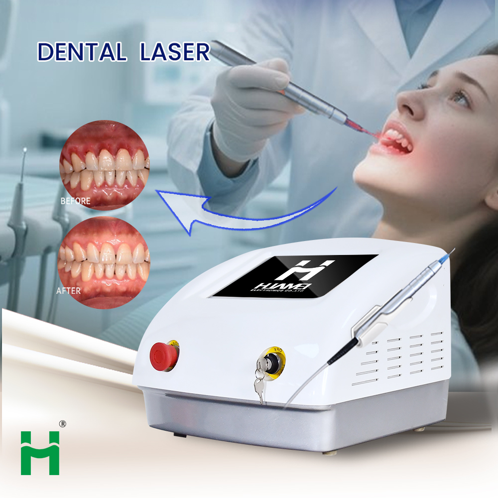 Draagbare LED-tandbleekset: 15 - Teeth Whitening Bleaching Kit recensie en prijs