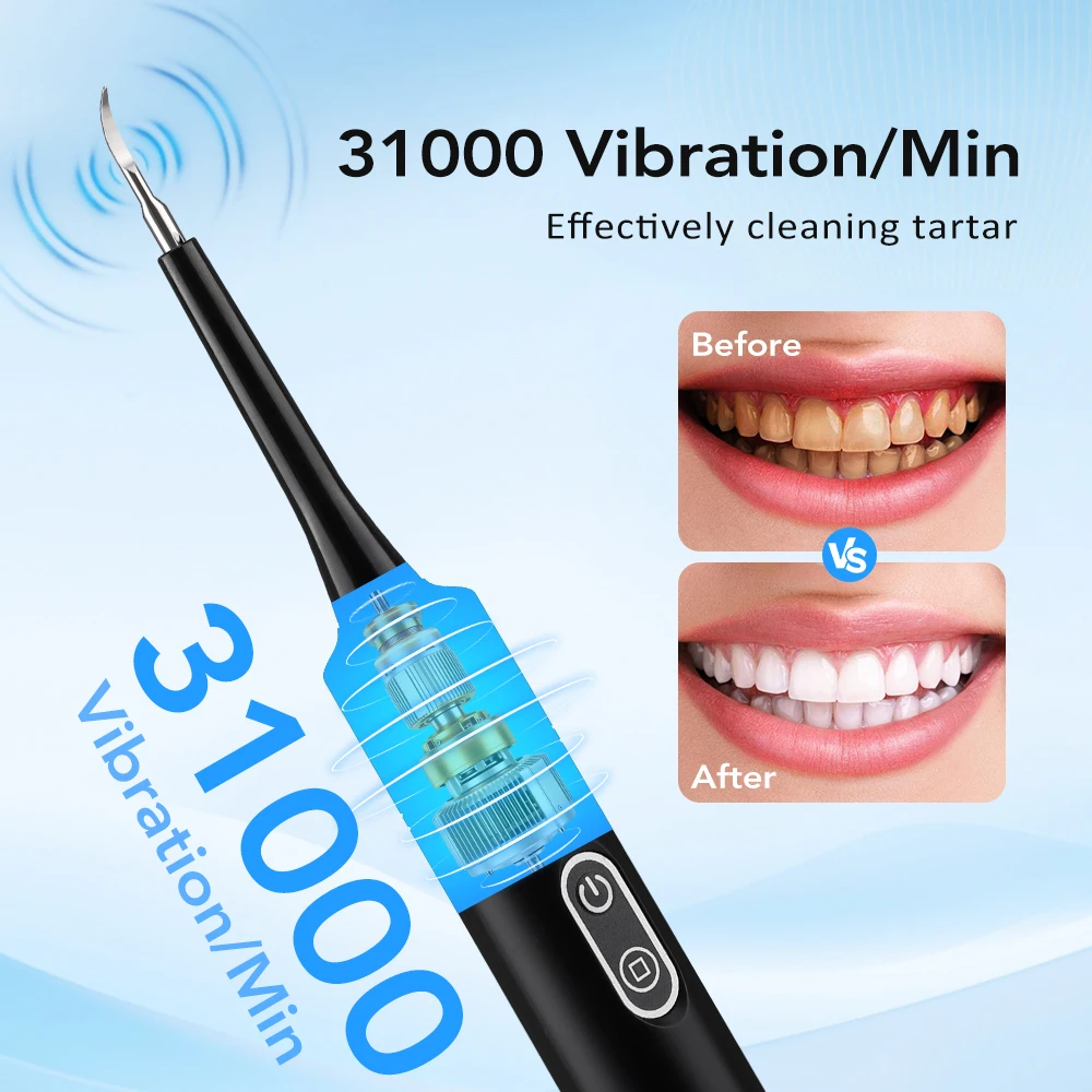 Elektrische sonische vibratie  - Whitening Teeth Dentist recensie en prijs